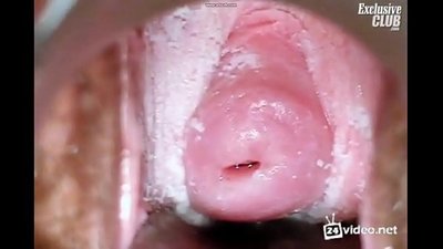एक खूबसूरत महिला की स्त्री रोग संबंधी परीक्षा